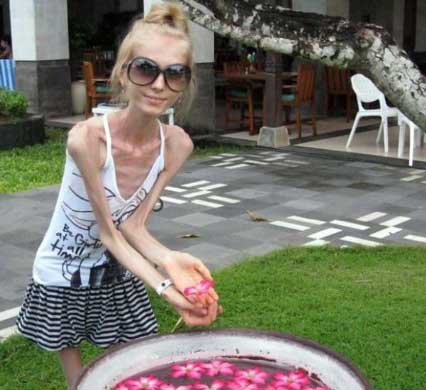 Ksenia Bubenko Diyet Sonrası Bu hale Geldi! 2