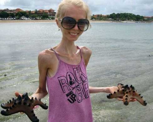 Ksenia Bubenko Diyet Sonrası Bu hale Geldi! 3