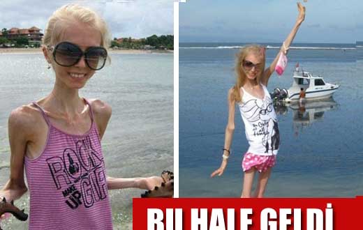 Ksenia Bubenko Diyet Sonrası Bu hale Geldi! 5