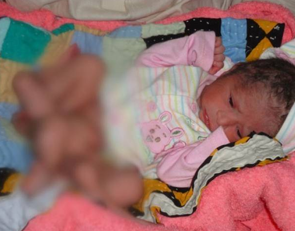 6 bacaklı bebek dehşete düşürdü 5