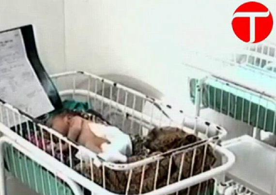 Aman Allah'ım! Şimdi de üç kollu bebek 3