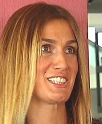 Ünlülerin eski dişlerine bakın! 18