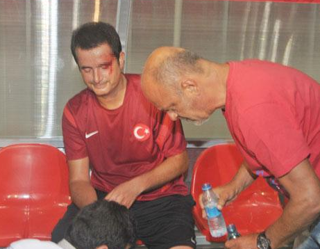 Efsaneler Cup turnuvasında Acun Ilıcalı'nın kaşı yarıldı 1