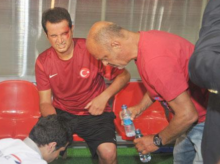 Efsaneler Cup turnuvasında Acun Ilıcalı'nın kaşı yarıldı 2