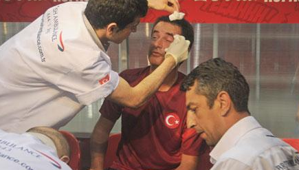 Efsaneler Cup turnuvasında Acun Ilıcalı'nın kaşı yarıldı 4