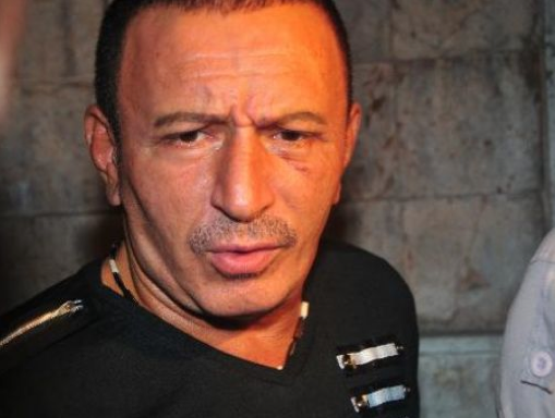 Botokslu Mustafa Topaloğlu 1