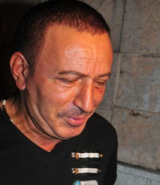 Botokslu Mustafa Topaloğlu 2