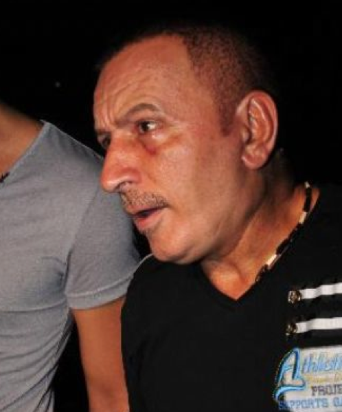 Botokslu Mustafa Topaloğlu 4