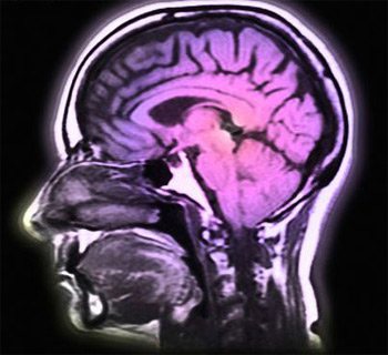 Alzheimer'a ne kadar yakınsınız. İşte size beyninizi test edebileceğiniz gerçek bir test 5