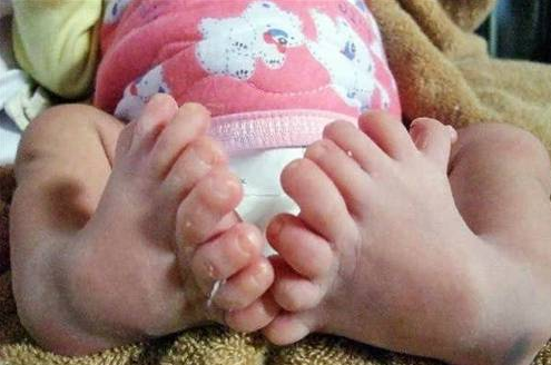 Bu hastalıklar çok korkunç! 12