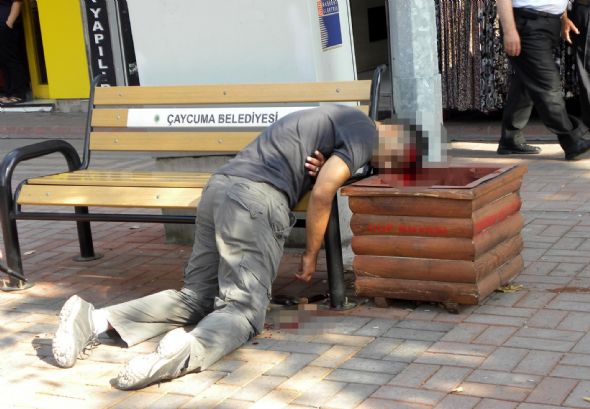 Bu görüntü kan dondurdu (+18) 1
