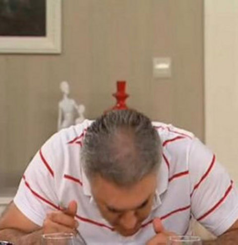 Saç ektiren ünlüler 19