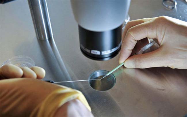 Ölümün testini buldular! 5