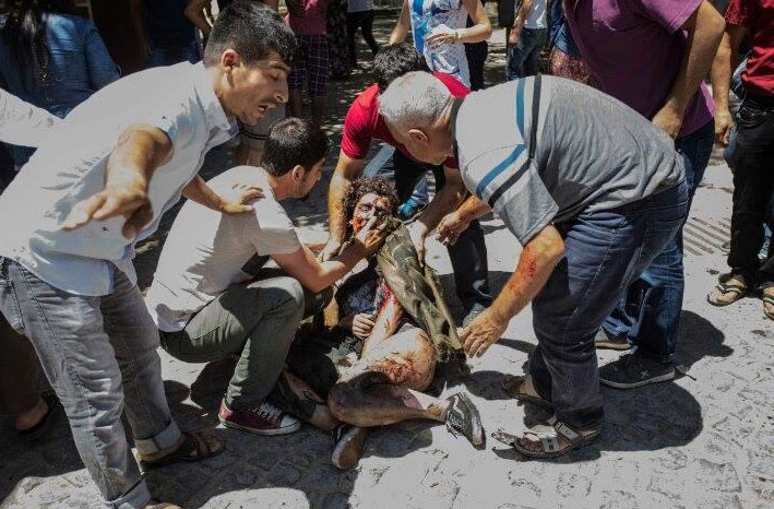 Şanlıurfa, Suruç patlamasından arda kalan fotoğraflar 13