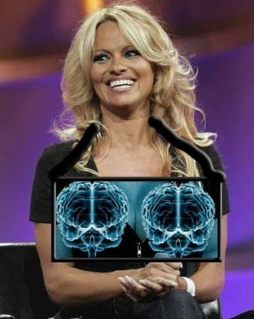 X-Ray komedisi 13