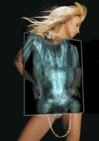 X-Ray komedisi 2