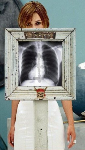 X-Ray komedisi 4