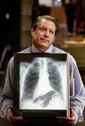 X-Ray komedisi 6