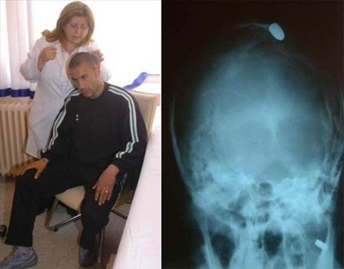 Türkiye'den gülme krizine sokan kareler 23