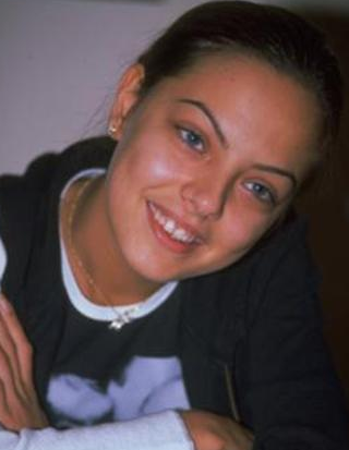 Dişlerini elden geçiren ünlüler 16