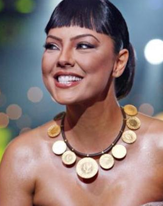 Dişlerini elden geçiren ünlüler 17