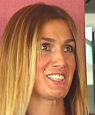 Dişlerini elden geçiren ünlüler 18