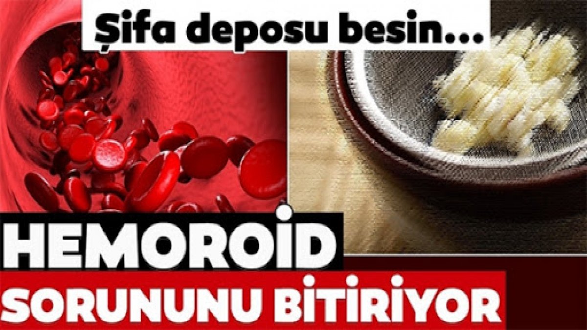 Hemoroid kesin olarak bu besinlerle yok ediliyor üstelik en etkili yiyecek ise o..