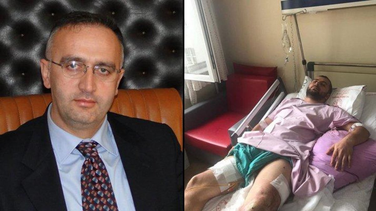 Ülkenin gündemine oturan skandal AKP'li başkan tartıştığı esnafı bacağından vurdu!