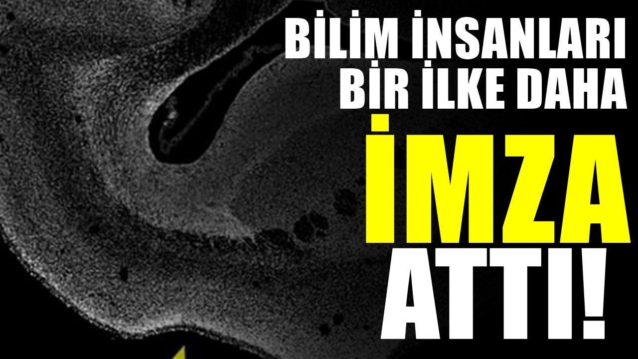 Bilim insanlarından bir ilk. Zeka etkileyen gen üzerinden beyni büyütmeyi başardılar