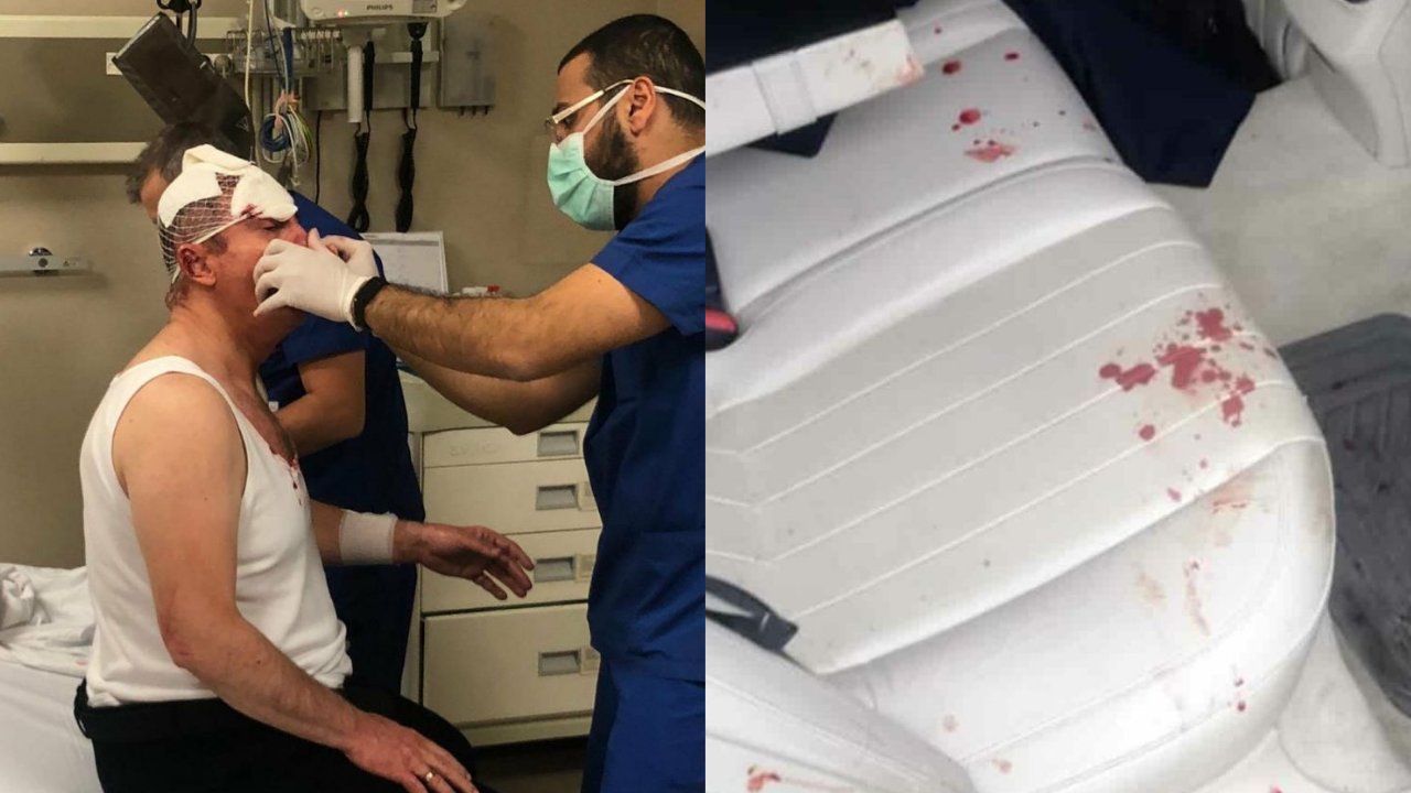 Şüpheli saldırganlar tesadüfen oradan geçtiklerini söyledi