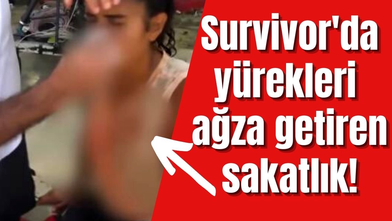 Survivor'da korkunç kaza! Sakatlanan oyuncunun yüzü kanlar içinde kaldı, hemen hastaneye kaldırıldı!