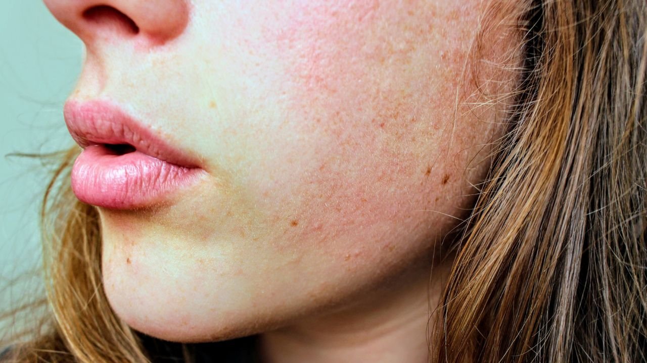 Kuru cilt tipi için bu maske capcanlı yapıyor! Tam mevsimiyken bu maskeyi hemen yapın