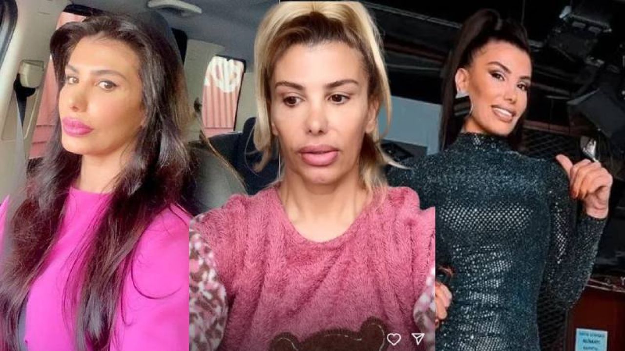 Hatice, botoks zehirlenmesi sonucu yaşadığı değişimi paylaştı