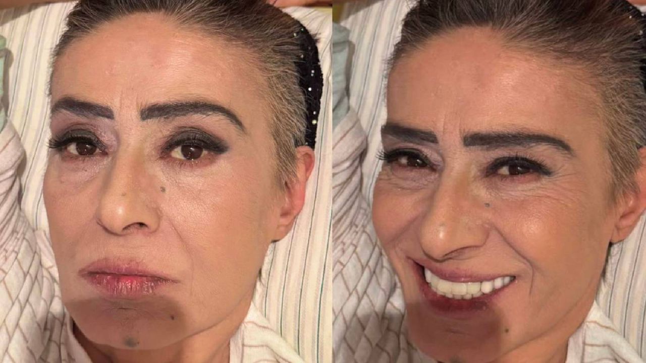 Yıldız Tilbe: Yaralarım Geçmeyecekti Açıklaması Yapıldı