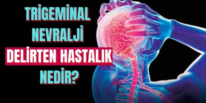 Trigeminal Nevralji (Delirten Hastalık) nedir, belirtileri ve tedavisi nasıldır? Umut Akyürek'in hastalığı ne?